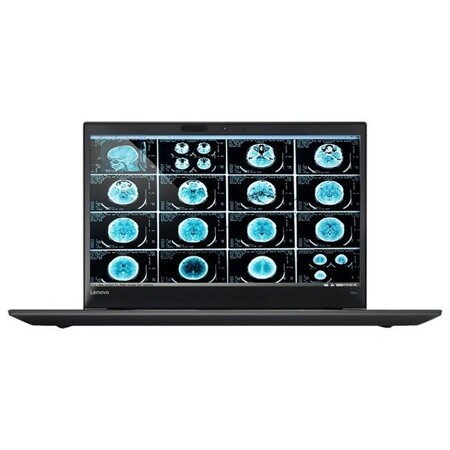 Lenovo ThinkPad P51s: характеристики и цены